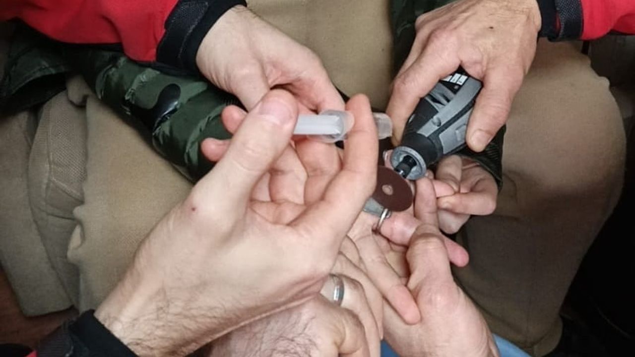 Rize'de itfaiye 50 kuruşluk madeni halkayı parmağından çıkararak 10 yaşındaki çocuğu kurtardı