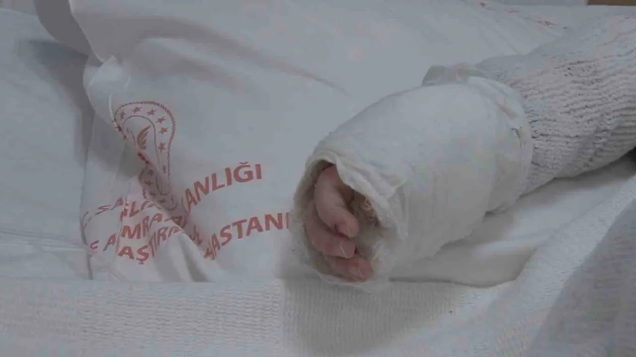 İstanbul'da kaynar su kazası: 20 aylık bebeğin vücudunun yüzde 27'si yandı