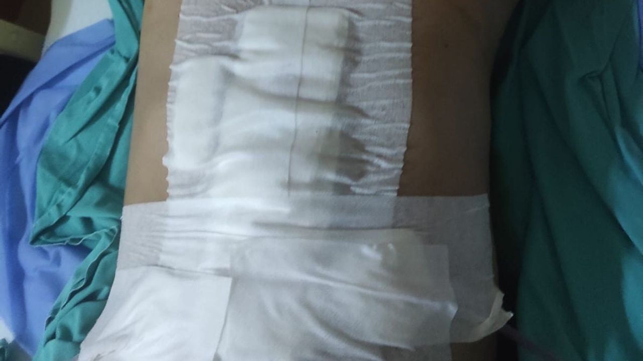 Bandırma’da balon atış alanında havalı tüfek kazası: 1 kişi ağır yaralandı