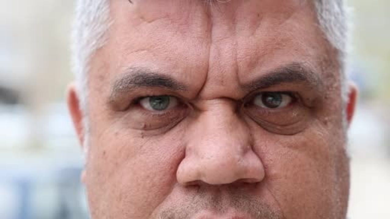 Kahramanmaraş'ta üç renkli gözleriyle dikkat çeken Mehmet Eser