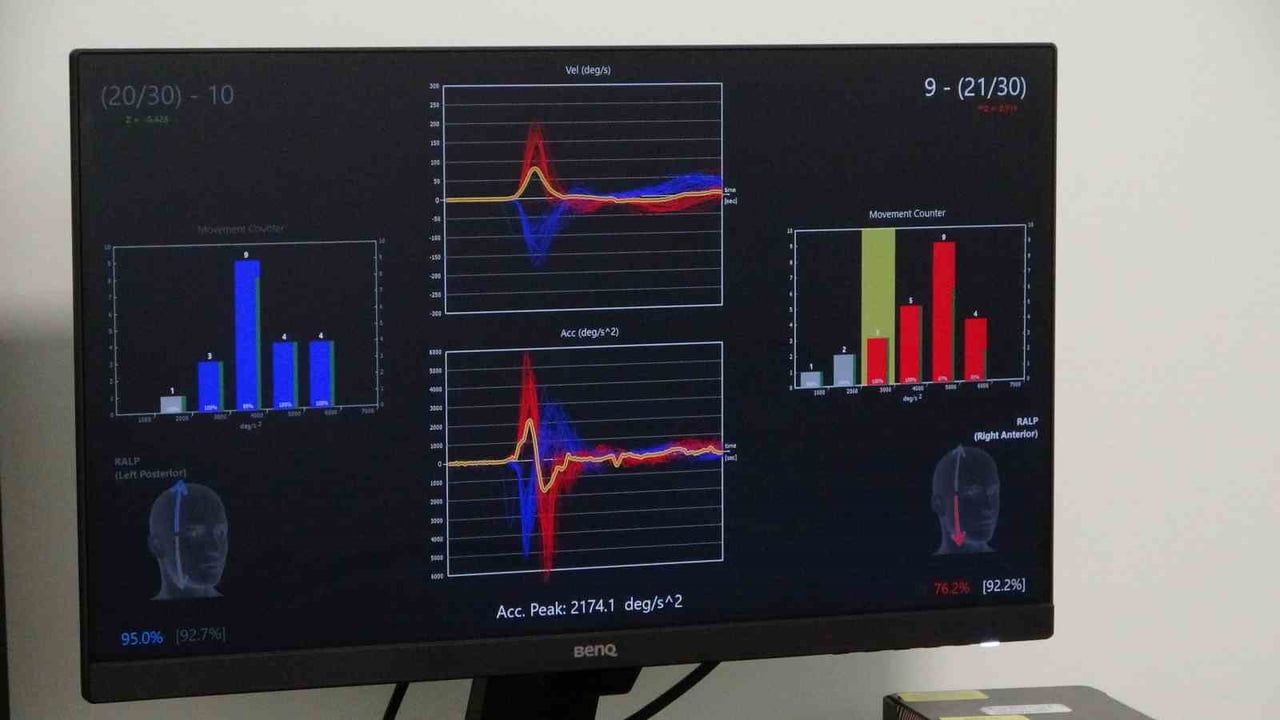 Malatya'da vertigo tedavisinde referans: İnönü Üniversitesi Turgut Özal Tıp Merkezi