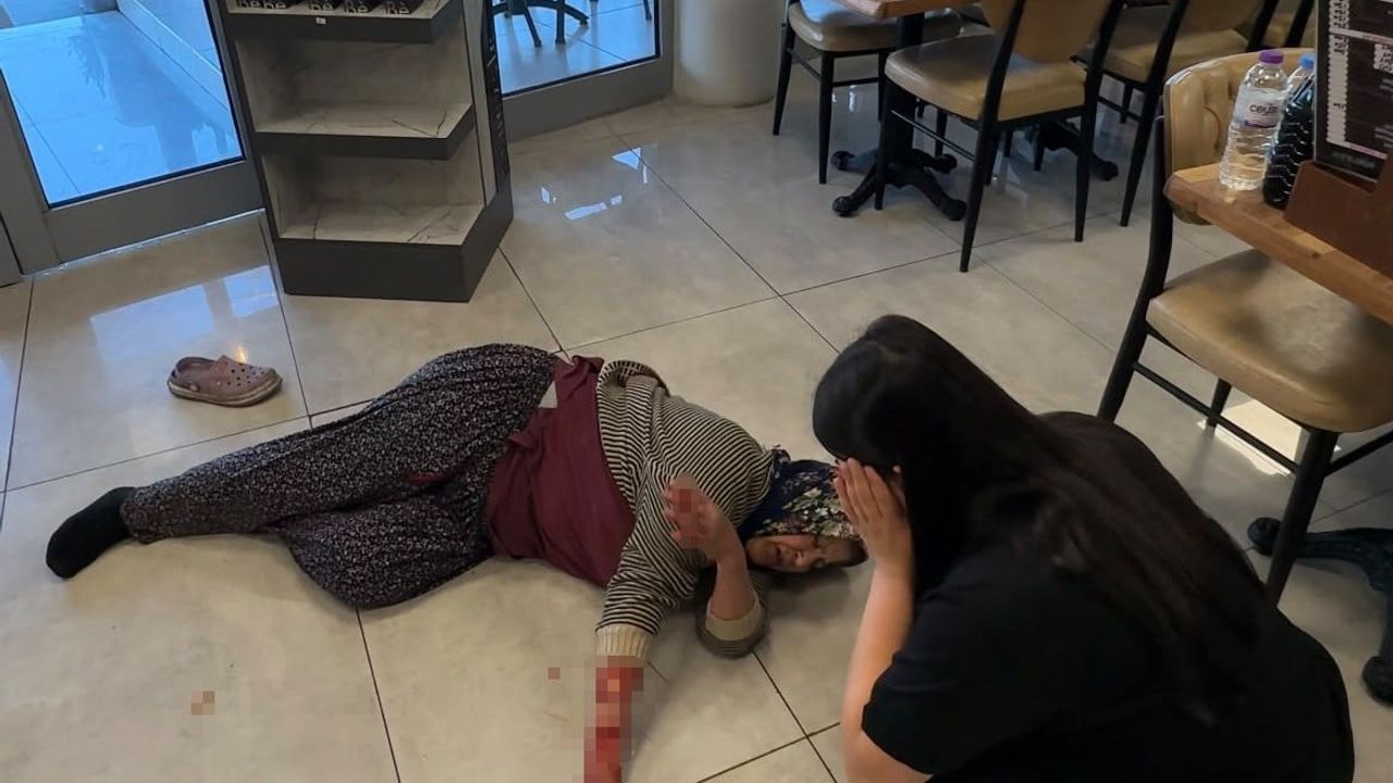 Dinlenme tesisinde başıboş köpek kadının kolunu kopardı