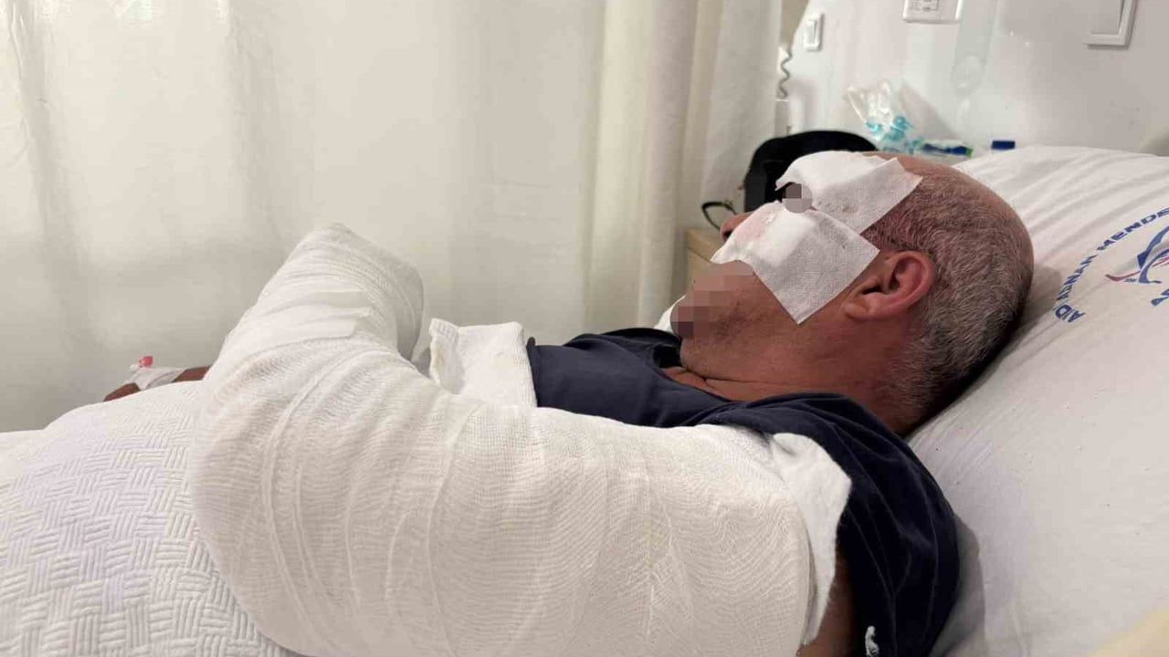 Efeler'de motosiklet kazasında sürücü yaralandı, kardeşinin çarptığını iddia etti