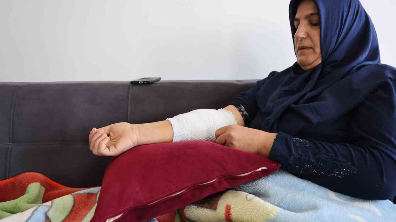 Elazığ otogarında başıboş köpek saldırısı: Yaralanan kadın yaşadıklarını anlattı