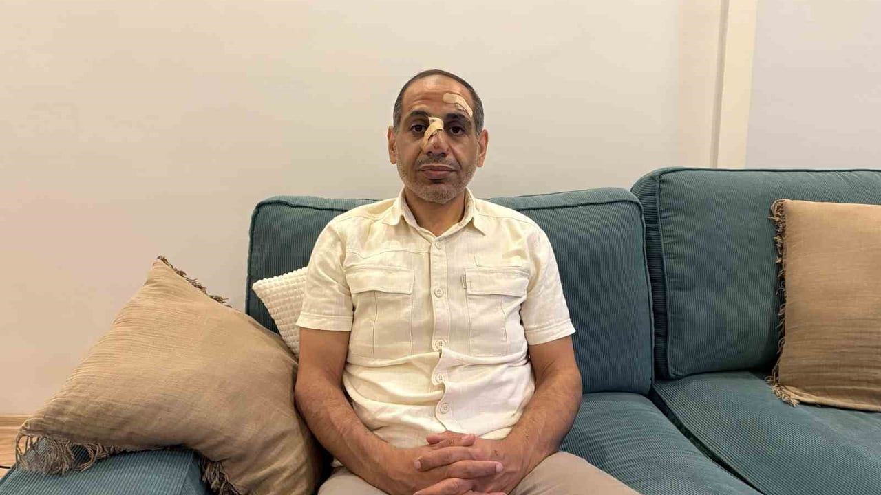 Esenyurt’ta park halindeki araca çarpan sürücü araç sahibini darp etti