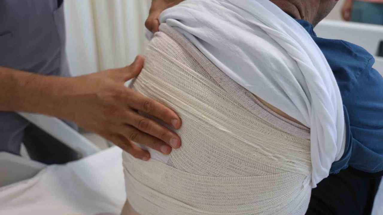 Hatay’da 10 yıldır büyüyen kitle alındı: Sırttan 1,5 kilogramlık tümör çıkarıldı