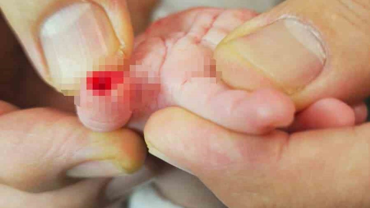 Hatay'da serum çıkarma sırasında 5 aylık bebeğin parmağı kesildi; aile hemşire hakkında şikayetçi oldu