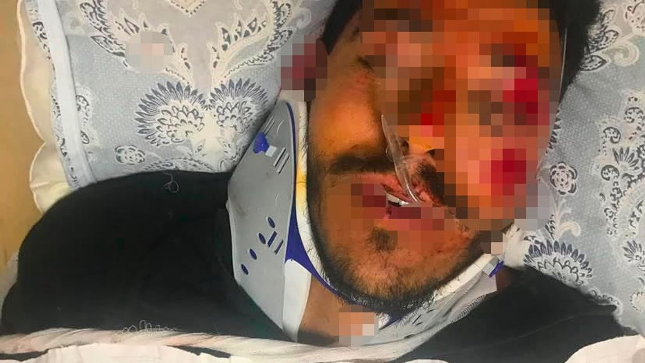Beylikdüzü'nde araç çarpması: 2’si ağır 6 kişi yaralandı