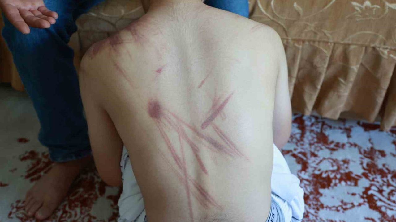 Elazığ'da özel eğitim merkezinde darp iddiası: baba hastane ve adliyeye gitti
