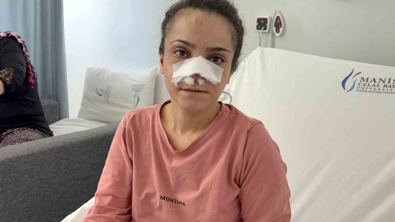 Eşinin ısırıp kopardığı burun Manisa'da başarılı operasyonla yerine dikildi