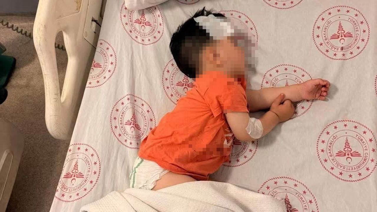 Halfeti'de sokak köpeklerinin saldırdığı 1 buçuk yaşındaki çocuk yaralandı