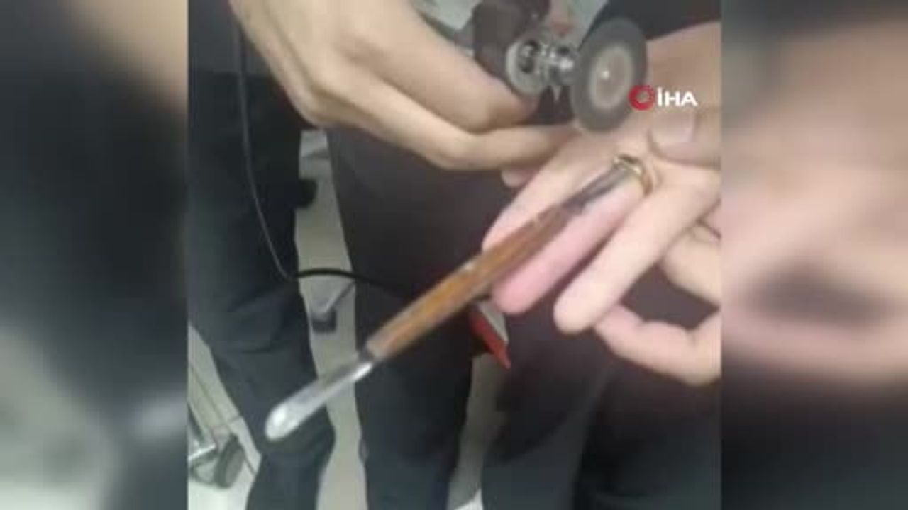 İtfaiyeden hastanede hassas müdahale: parmağa sıkışan yüzük çıkarıldı