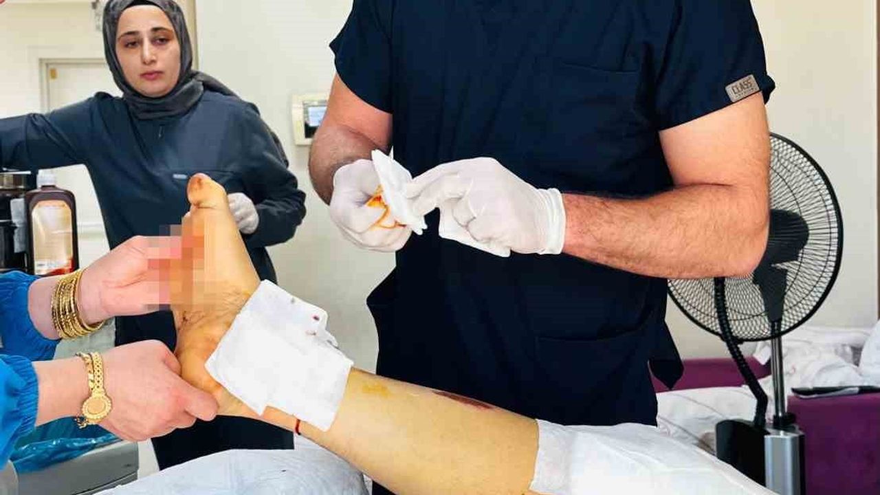 Siirt'te beton mikserine kaptırılan bacak ameliyatla kurtarıldı