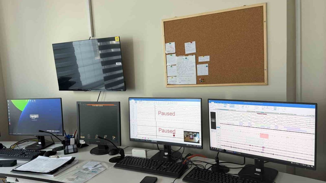 Yunus Emre Devlet Hastanesi'ne 4 yataklı uyku laboratuvarı açıldı