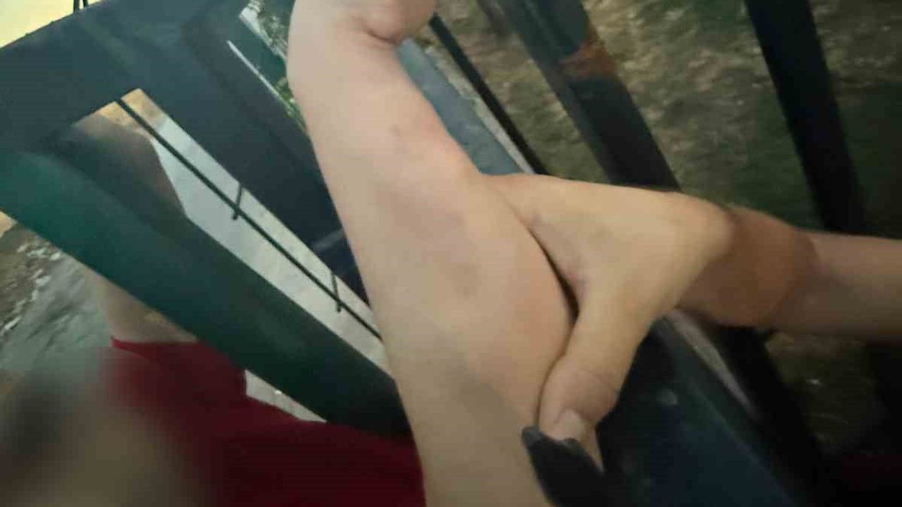 Bahçe korkuluğuna sıkışan vatandaş itfaiye müdahalesiyle kurtarıldı