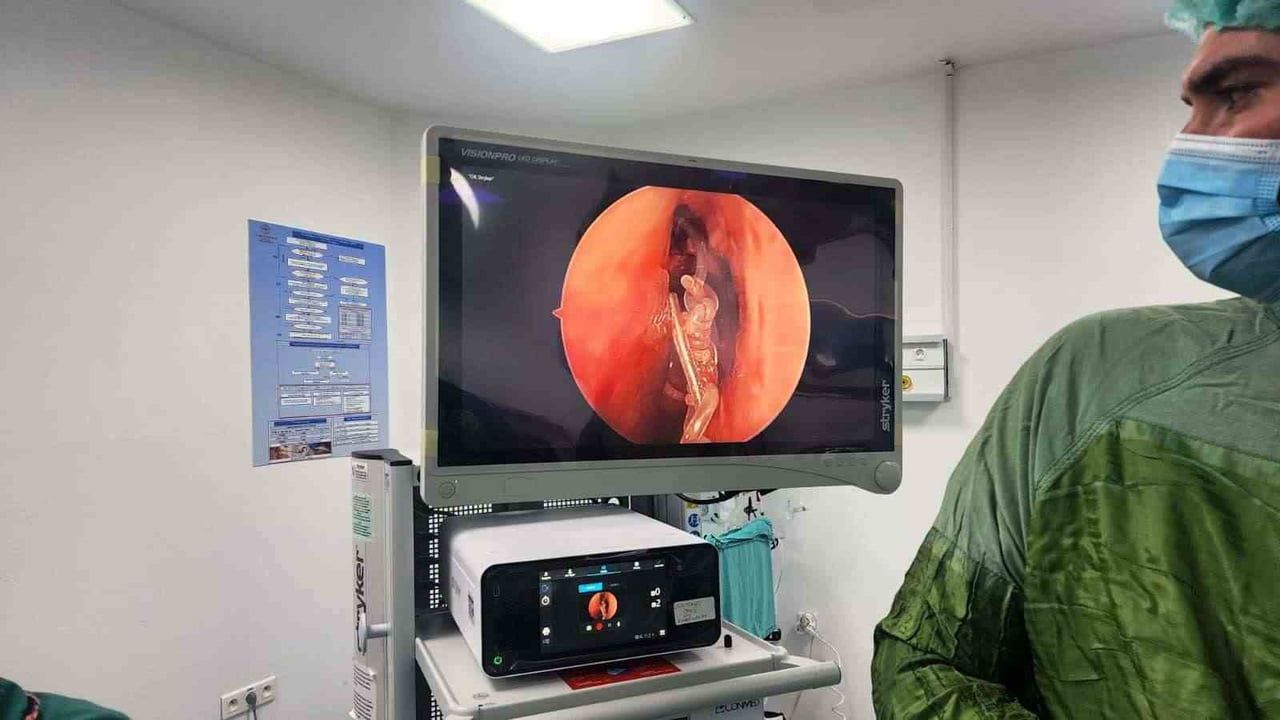 Burundan yerleştirilen tüple tıkalı gözyaşı kanalı açıldı