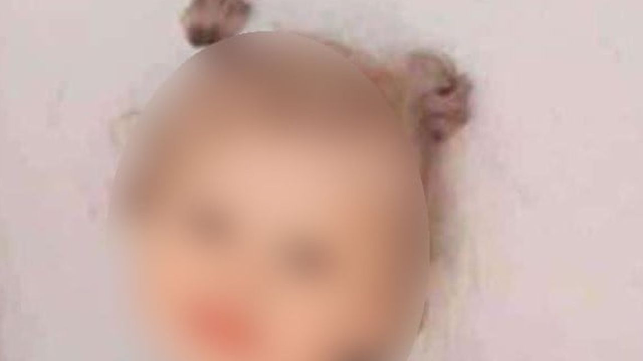 Diyarbakır'da 4 yaşındaki çocuk kedi ısırığı sonrası kuduz tedavisi sırasında hayatını kaybetti