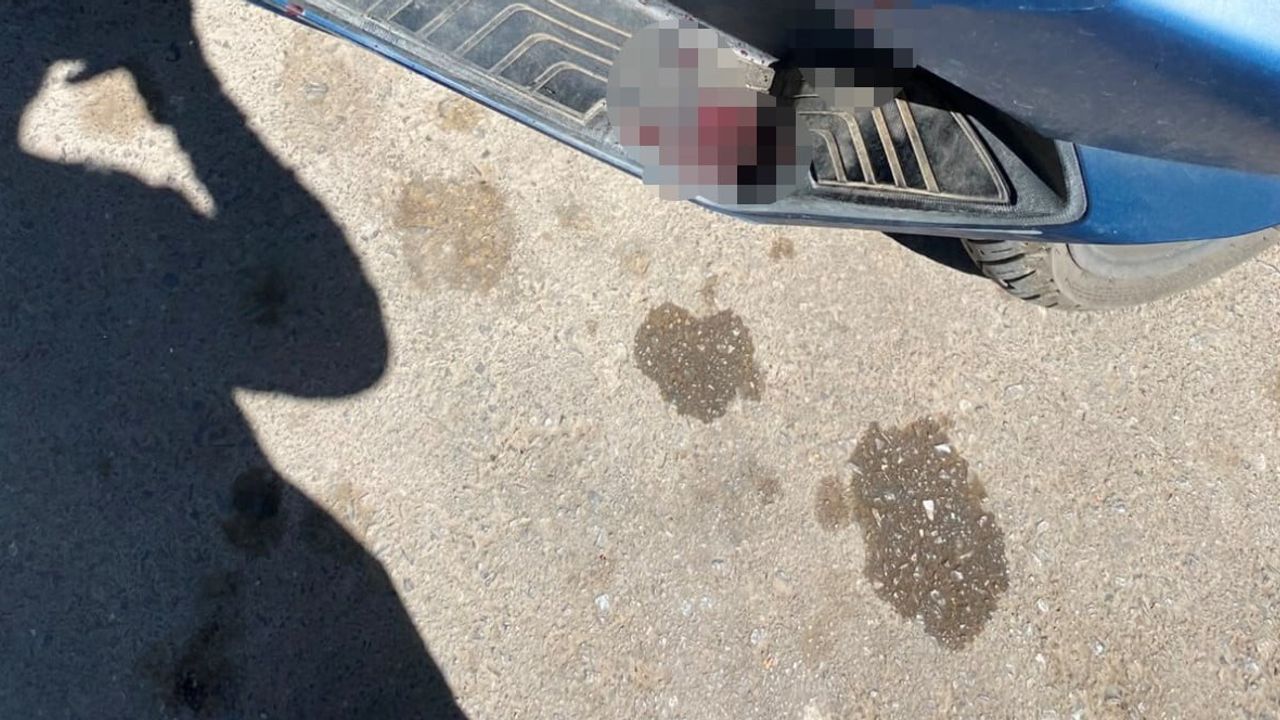 dönerci kavgasında bıçaklı saldırıya uğrayan motokuryenin iki parmağı dikildi