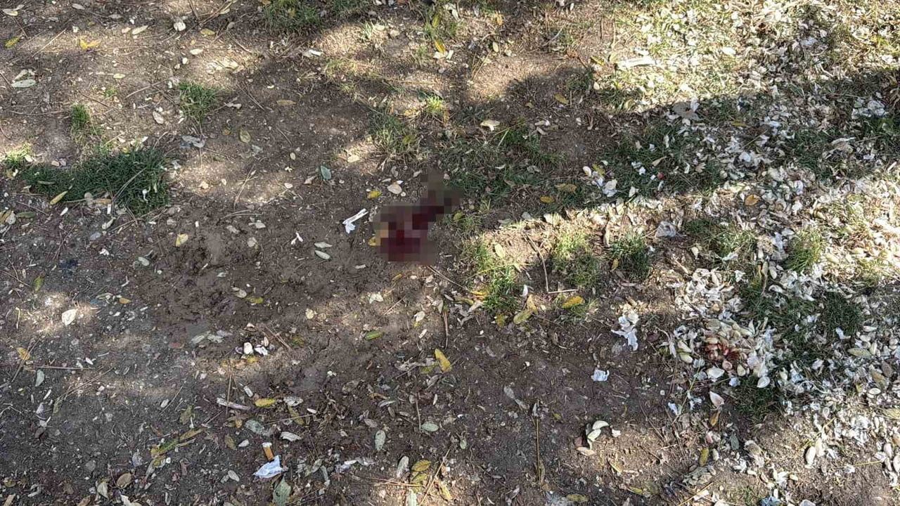 Eskişehir'de parkta döner bıçağıyla yaralama: şüpheli yakalandı