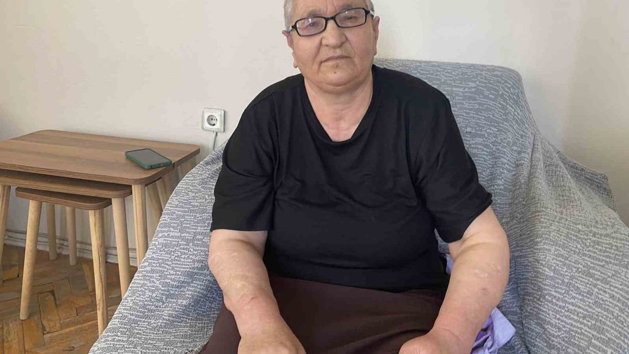 Kırşehir'de köpek saldırısı: 637 bin lira tazminat kararı onandı