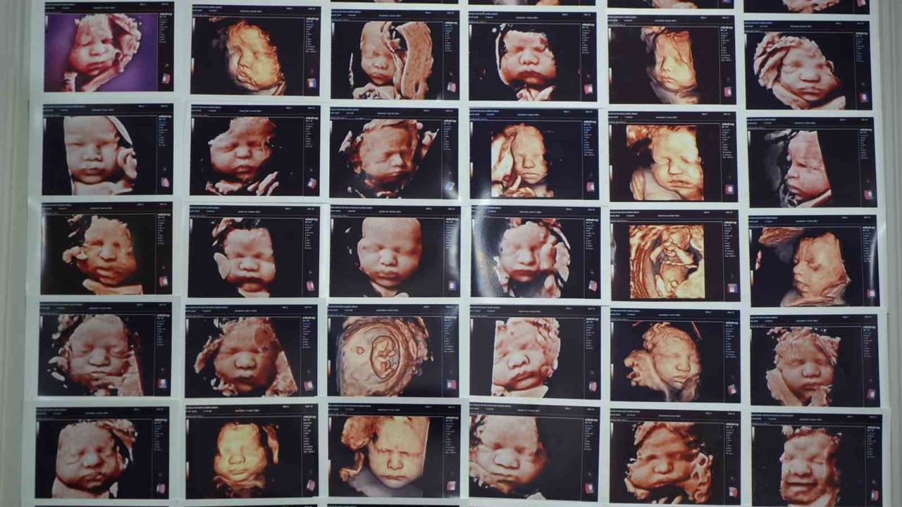 Kişiye özel protokolle 7 yıllık bebek hasreti sona erdi