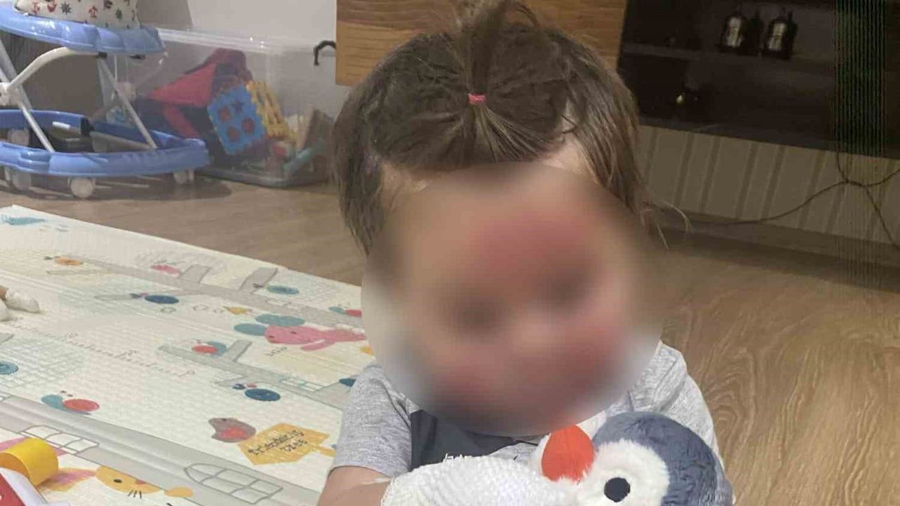Konserve patlamasına kapılan bebekten iyi haber: 9 aylık Eliz aylar sonra tamamen iyileşti