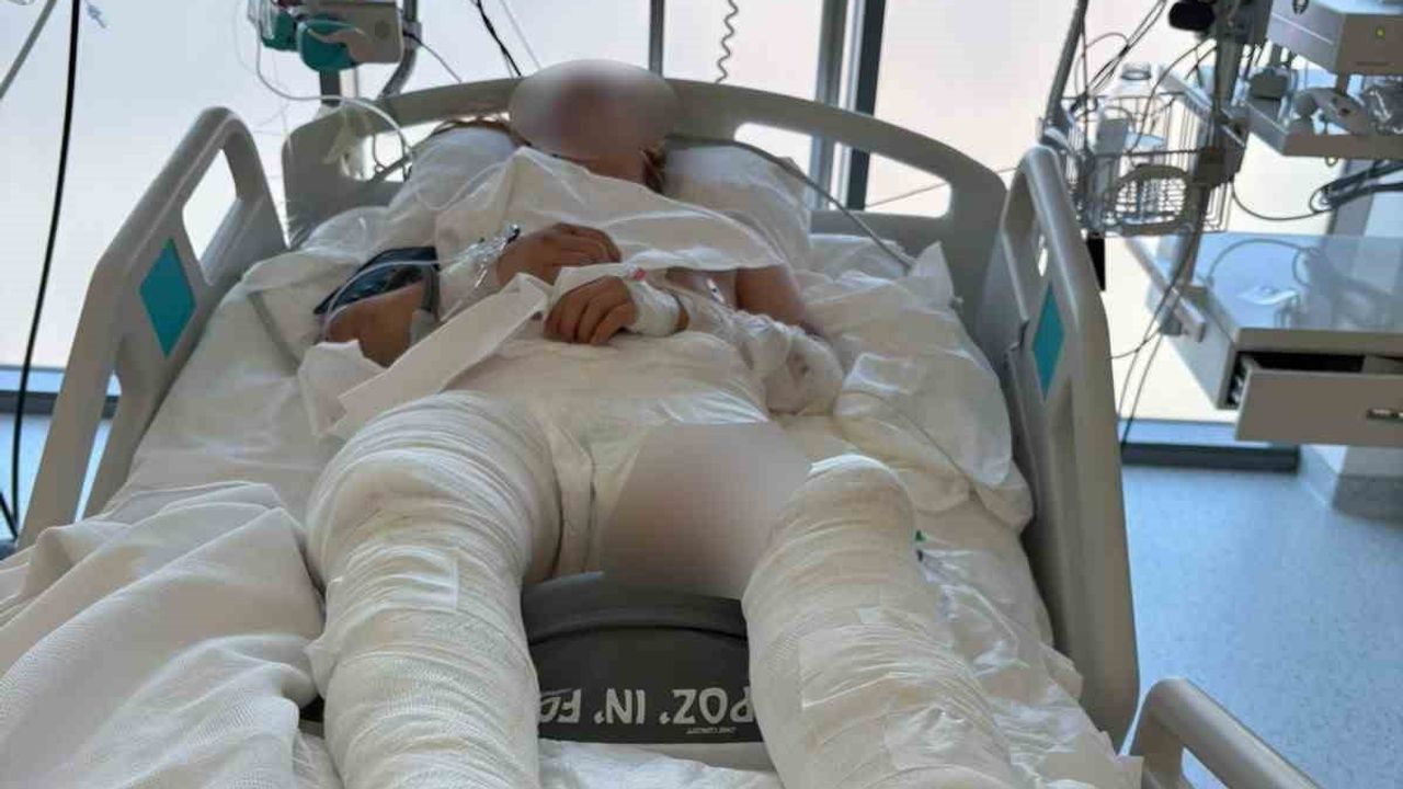 otomobilin üzerinden geçtiği genç kız yoğun bakımda