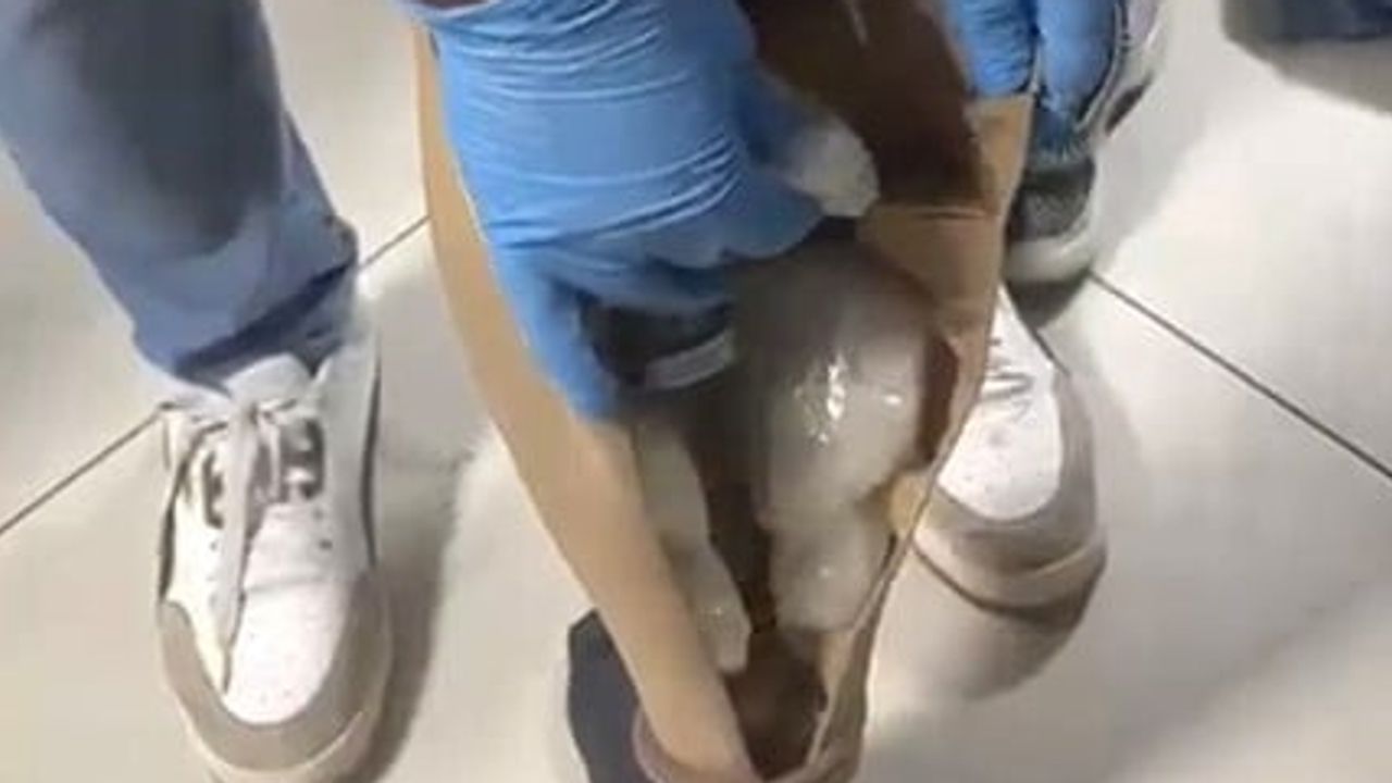 Protez bacağına gizlediği 830 gram metamfetaminle yakalandı