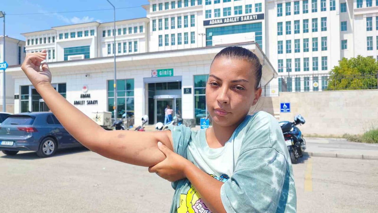 Selamı yüzünden asansörde darp: cankurtaran genç kadından suç duyurusu