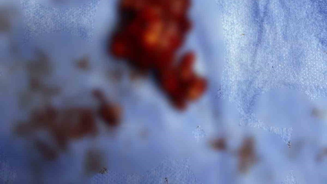 Bilecik'te ameliyatla yaşama döndürülen sokak köpeği sağlığına kavuştu