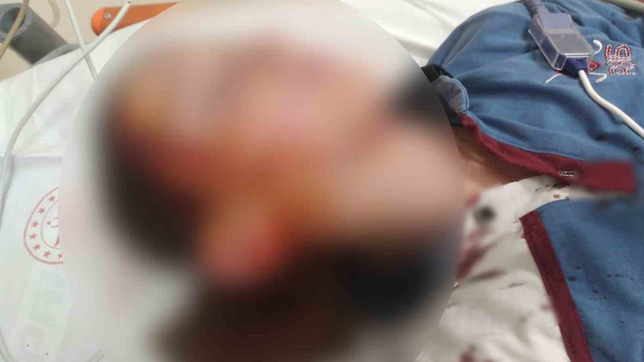 Çocuğun yüzünde iz bırakan köpek davasında 1,2 milyon lira tazminat