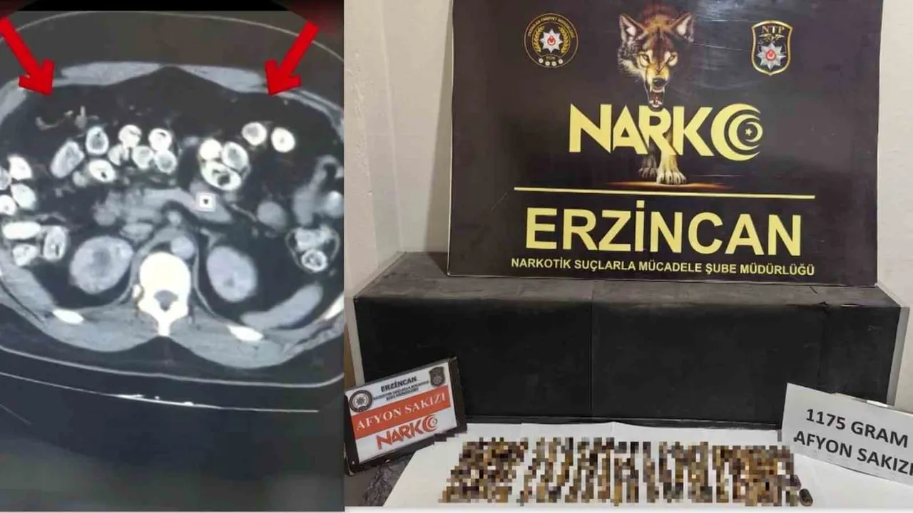 Erzincan'da kapsül yöntemiyle taşınan 2 kilo 770,83 gram afyon sakızı, üç kişinin tutuklanmasıyla ortaya çıktı