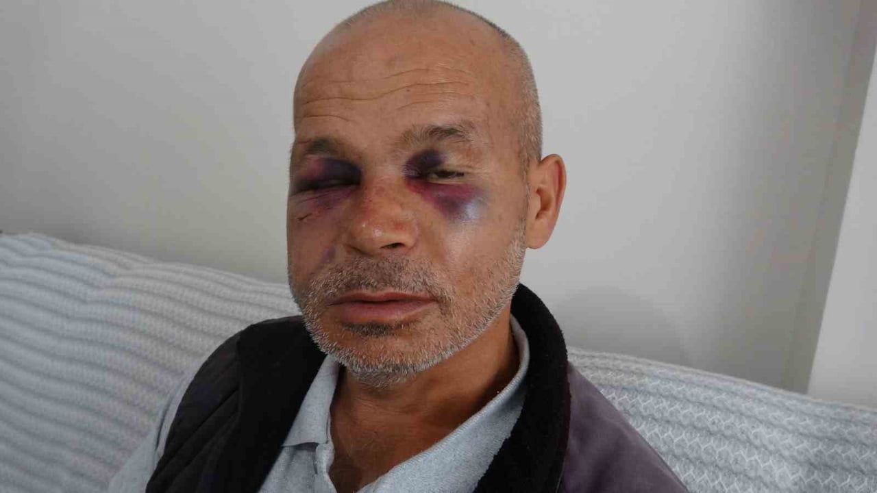 Kozan'da engelli vatandaşa saldırı: gözaltındaki şüpheli ifadesinin ardından serbest bırakıldı
