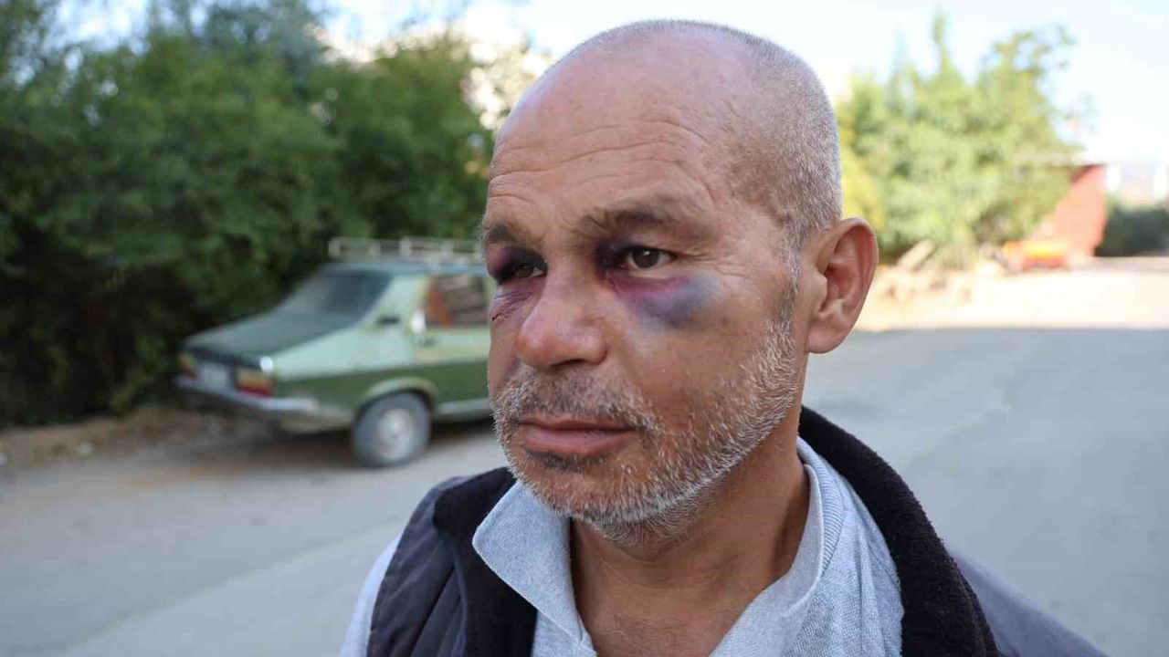 Kozan'da iş dönüşü darp edilen duyma ve konuşma engelli adamın ailesi şikayetçi oldu