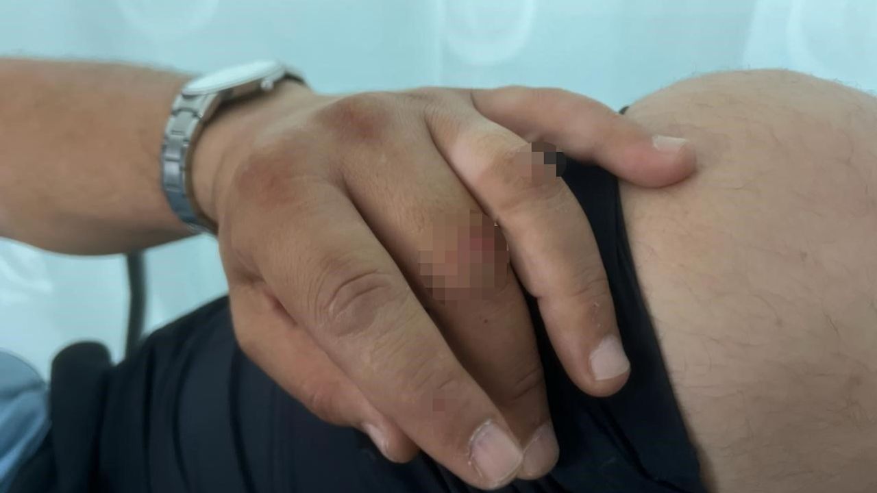Mudanya'da zabıta memuruna saldırı sonrası koruma çağrısı