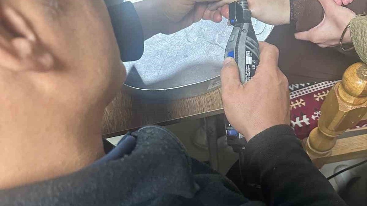 Batman'da hastane ve itfaiyenin ortak müdahalesiyle sıkışan yüzük güvenle çıkarıldı