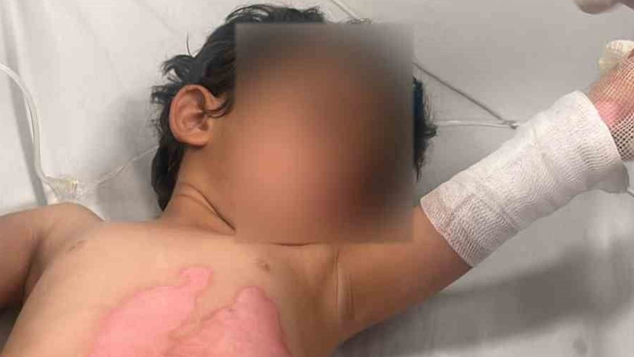 Evde ısıtılan kazan devrildi: 3 yaşındaki İ.A.T. yanıklarla hastaneye kaldırıldı