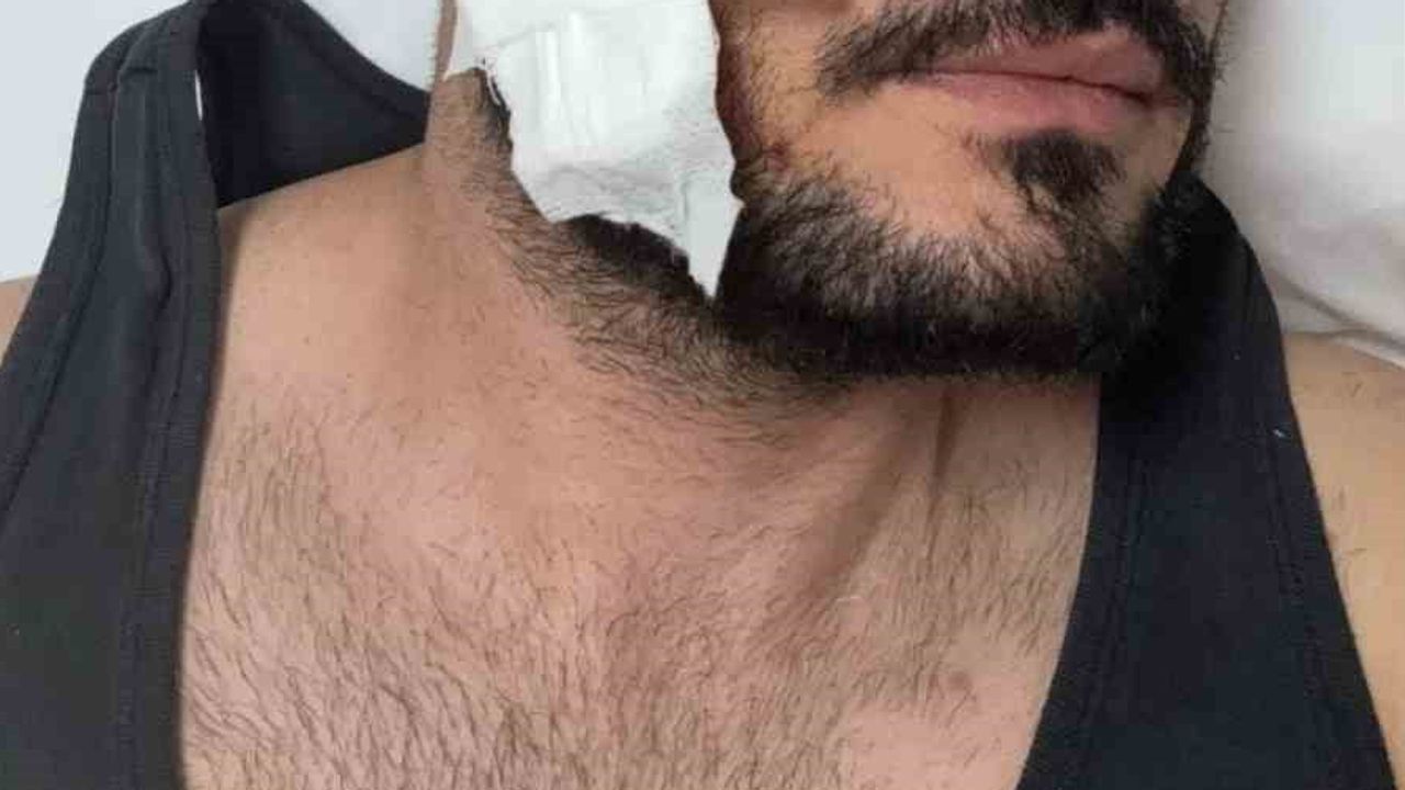 İnek tartışması kavgaya dönüştü: avukat müvekkilinin muşta kullanmadığını savundu