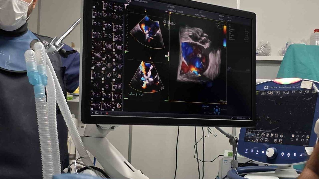 İzmir'de mitral kapak onarımında yeni adım: açık kalp ameliyatı olmadan müdahale