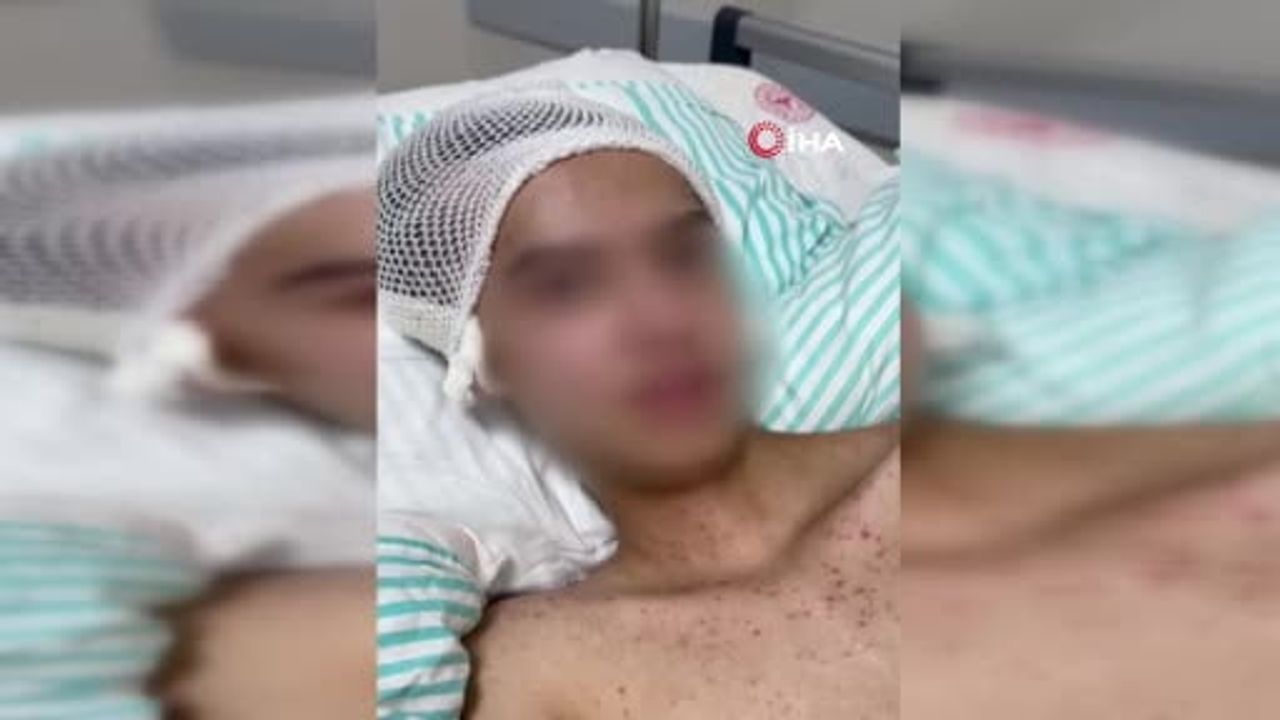 Tacize direnince başından vurulan çocuk için 3 suçtan ceza istendi
