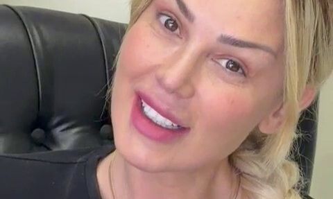 Petek Dinççöz'ün estetik sonrası makyajsız fotoğrafı Prof. Dr. Hayati Akbaş tarafından paylaşıldı