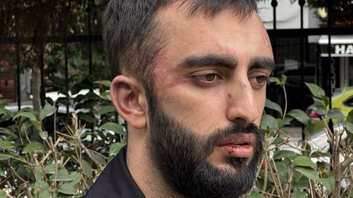 İzmir Buca'da Köpeklerden Kaçan Kişiye Saldırı: İki Şüpheli Tutuklandı