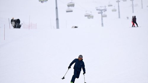 Kangrenden Bacağını Kaybeden Genç Sporla Hayata Tutundu