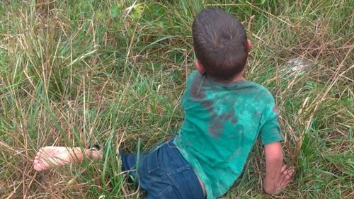 Yalova Valiliği'nden Sahipsiz Köpeklerin Saldırısına Uğrayan Çocukla İlgili Açıklama