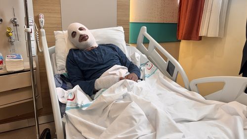 Erzurum'da Isıtan Genç, Sprey Boya Tüpünden Alev Alarak Yaralandı
