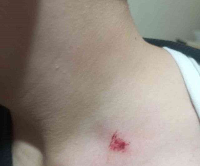 Antalya Kepez'te 7. sınıf öğrencisinin akran zorbalığı iddiasıyla yaralanması