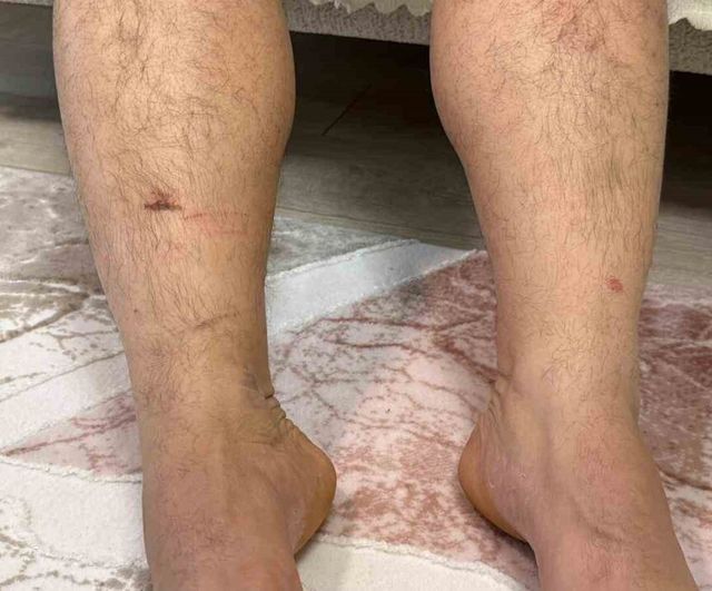 Diyarbakır’da Murat Hilez, Kuzenleri Tarafından Kaçırıldığını ve Şiddete Uğradığını İddia Etti