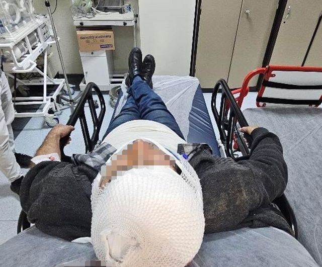 Kaynarca'da ev merdiveninden düşen A.G. (62) hastaneye kaldırıldı