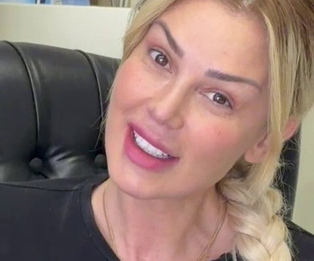 Petek Dinççöz'ün estetik sonrası makyajsız fotoğrafı Prof. Dr. Hayati Akbaş tarafından paylaşıldı