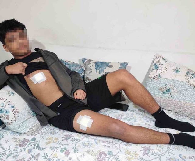 Adana'da 15 yaşındaki genç bıçaklı saldırıdan kurtuldu: 2 tutuklama, bıçaklayan şüpheli aranıyor